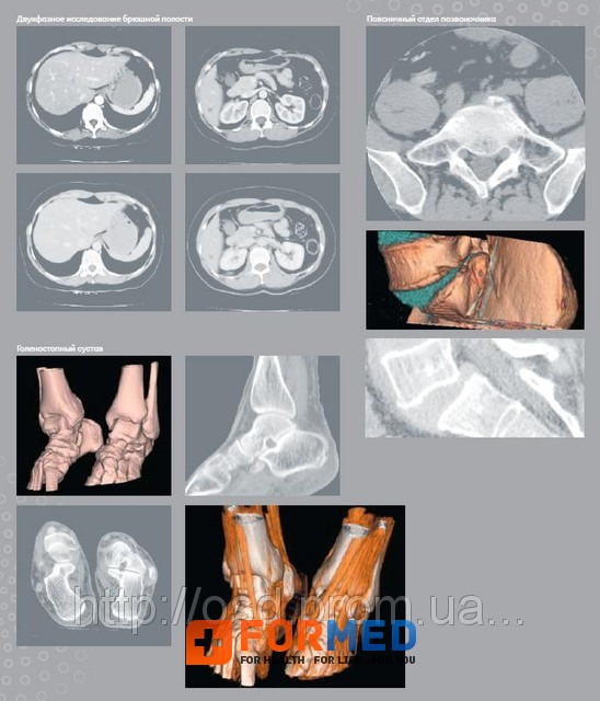 Компьютерный томограф Brivo CT325