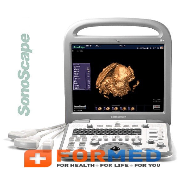 Портативный цветной цифровой аппарат ультразвуковой диагностики SonoScape S8