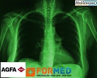 Рентгеновская пленка AGFA Curix Ortho HT-G 