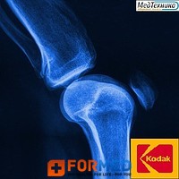   KODAK MXB Film () 