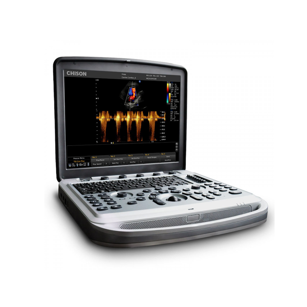 Ультразвуковий апарат SonoBook 6 (2 датчика+ мобільний візок) 