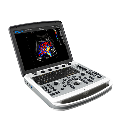 Ультразвуковий апарат SonoBook 6 (3 датчика)