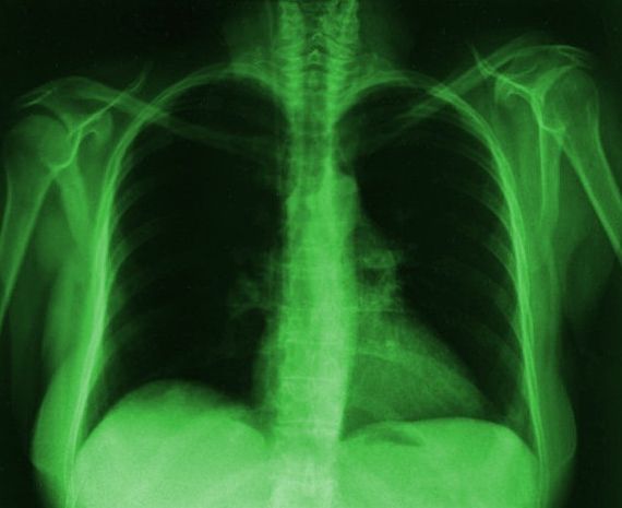 Рентгеновская пленка KODAK MXB Film (КОДАК) Зеленочувствительная