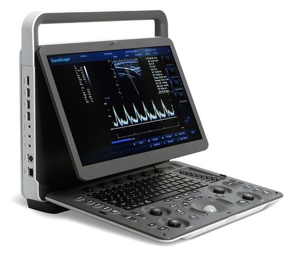 Портативный ультразвуковой сканер SonoScape E1 