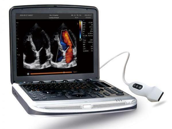   CHISON SonoBook 8